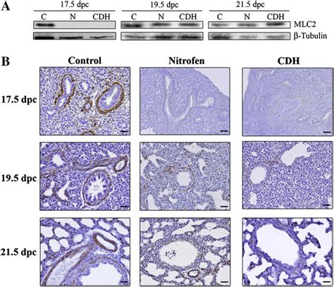 Mlc2 Expression During Normal And Hypoplastic Lung Development A