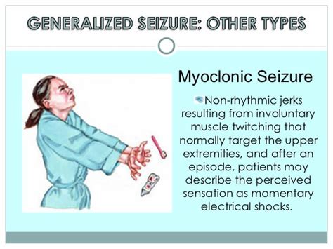 Myoclonic Epilepsyu