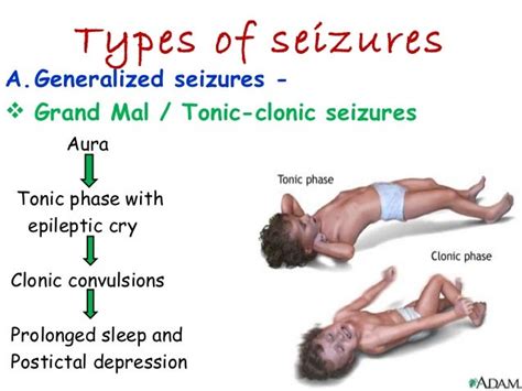 13antiparkinsonian Drugs Antiepileptics And Alcohol