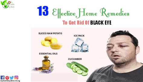 black eye 23 incredible ways to treat a black eye at home