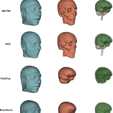 3d Surfaces Of Scalp Skull And Brain Estimated By Mr Tim Wts