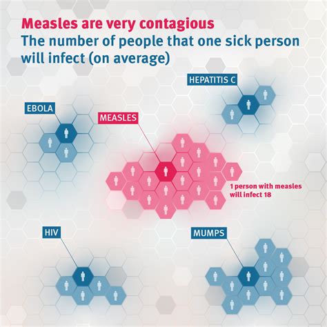 5 Things You Didnt Know About The Measles Queensland Health