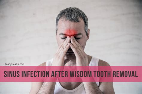 After the extraction process some inflammation is to be expected in the area. Sinus Infection After Wisdom Tooth Removal | Ear, Nose ...