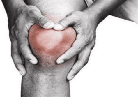 Early Symptoms Of Knee Arthritis Midwest Center For Joint Replacement
