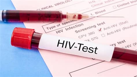 When Is The Most Accurate Hiv Test