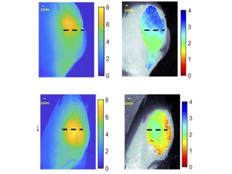 Fluorescence Imaging System Illuminates Tumor Depth Techlifely