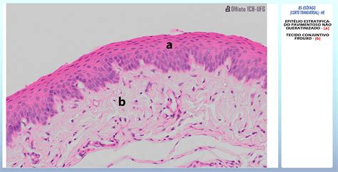 Imagens Da Histopatologia Tecido Conjuntivo Fibroso D Vrogue Co