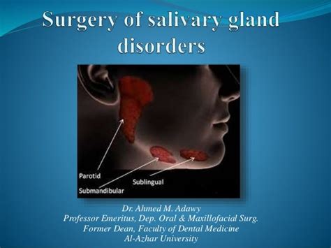 Surgery Of Salivary Gland Disorders