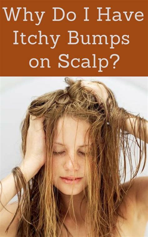 Here's how to get rid of those tiny red bumps on your arms. Scratching itchy bumps on scalp and have no idea what to ...