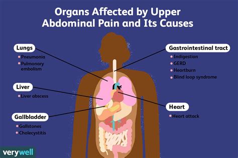 What Causes Upper Abdominal Pain 2022