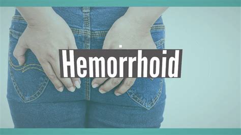 hemorrhoid prevention youtube