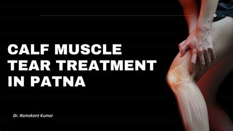 Dr Ramakant Kumar Best For Calf Muscle Tear Treatment In Patna