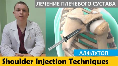 Локальная инъекция Лечение боли в плече АЛФЛУТОП Subacromial Shoulder Injections YouTube