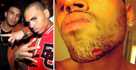 Chris Brown And Drake Fight Over Rihanna In Nightclub