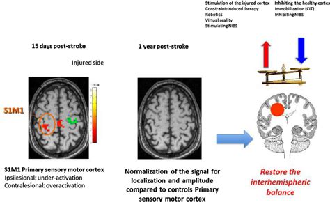 Principles Of New Rehabilitation Techniques Post Stroke Neuroimaging