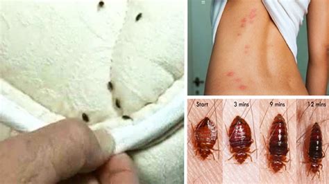 How To Get Rid Of Bed Bugs Naturally From Your Entire Home How To