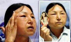 Chinese Woman Told Her Face Is So Thin She Looks Like Pauper Gets