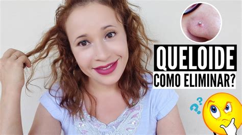 Dicas Para Eliminar Queloide Do Piercing Confira O Passo A Passo Por