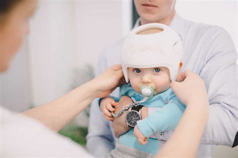 Plagiocephaly Helmets For Babies Melbourne Massons Healthcare