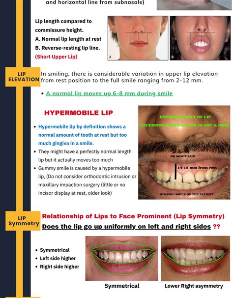 Smile Design Principles The Art Of Smile Designing Smile Makeover Prestige Dental Care
