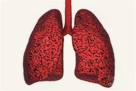 smoker s lungs photograph by kateryna kon science photo library fine art america