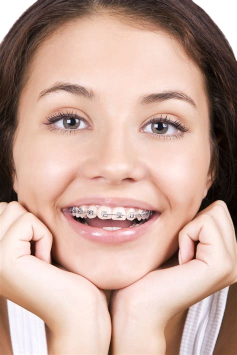 How Can I Pay For Braces Orthodontic Associates