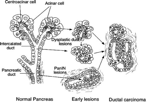 Schematic Presentation Of Cytogenesis Of Pancreatic Ductal