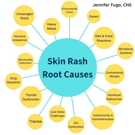 053 16 Root Causes Driving Skin Rashes Like Eczema Psoriasis