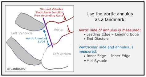 How To Master Aortic Measurements With These 5 Techniques Cardioserv