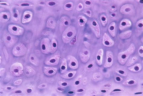 LM Of A Section Through Hyaline Cartilage Stock Image P174 0027