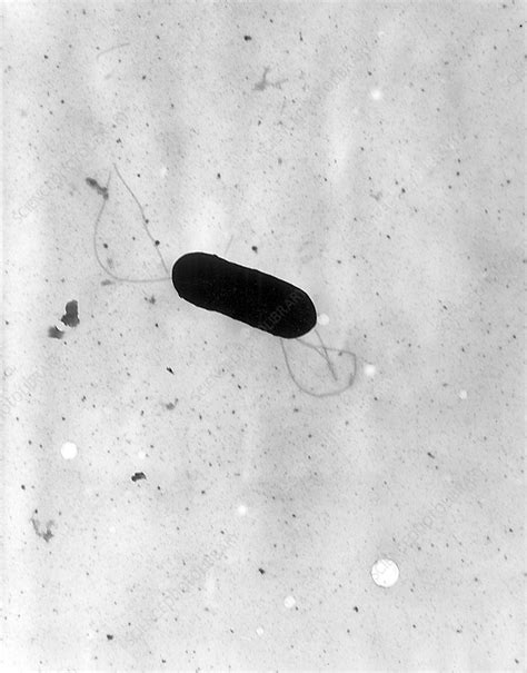 Listeria Monocytogenes Bacteria Tem Stock Image C0448708
