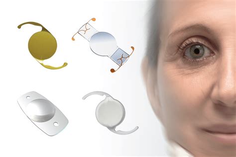 cataract surgery lens choices