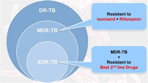 Drug Resistance Tb Management Summary Epomedicine