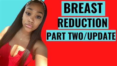 Breast Reduction Journey Part Two One Month Post Op Scarring Regrets Youtube