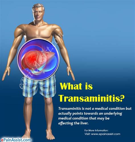 What Is Transaminitiscausessymptomstreatment
