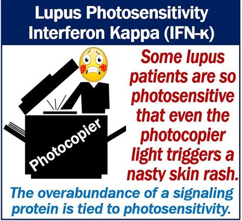 Photosensitivity Skin Rashes And Lupus Patients Immune Alarm