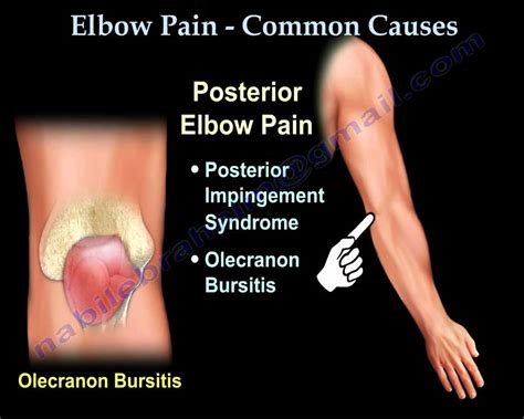 Elbow Pain Common Causes Everything You Need To Know Dr Nabil