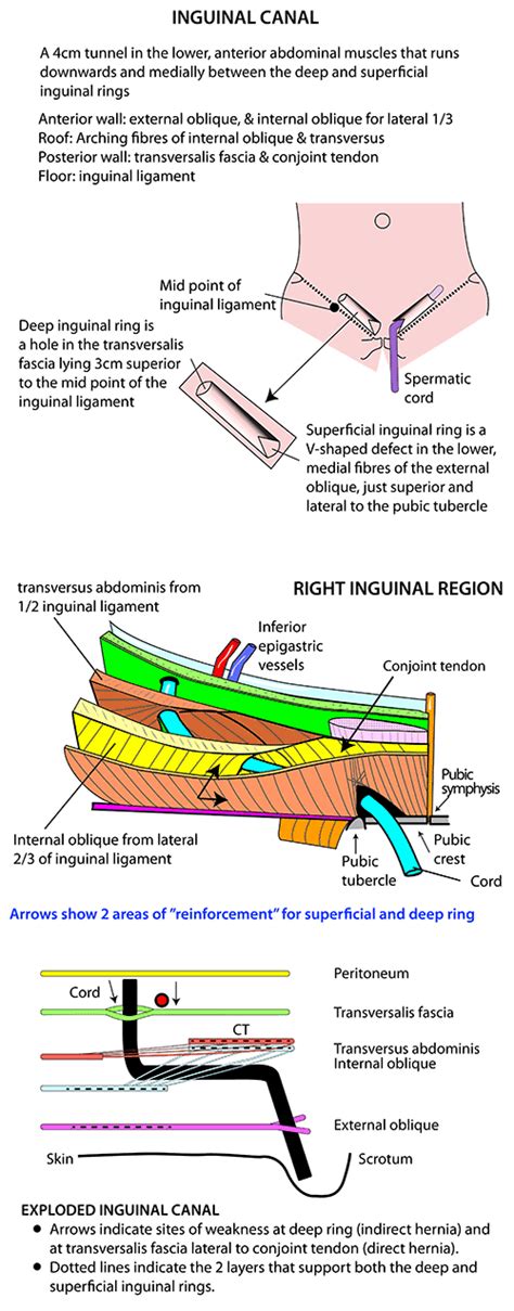 The inguinal canal is a passage in the inferior anterior abdominal wall which gives passage to the spermatic cord (male) or round. Instant Anatomy - Abdomen - Areas/Organs - Inguinal region ...
