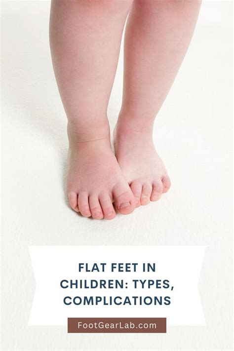 Flat Feet In Children Types Complications And Treatment Options Artofit