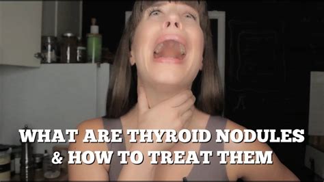 Best Natural Remedies For Thyroid Nodules Explainedand What Causes