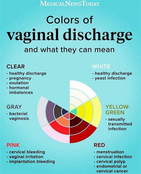 Vaginal Discharge Causes Colour Prevention Tips Ultimate Guide My Xxx