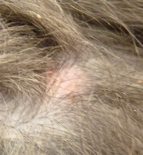 I Found A Small Pink Raised Bump On My Dogs Neck This Morning It Is