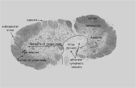 Hls Lymphoid Tissues And Organs Lymph Node Low Mag Labeled