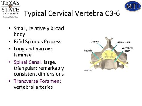 Cervical Spine Anatomy And Biomechanics Typical Cervical Vertebra