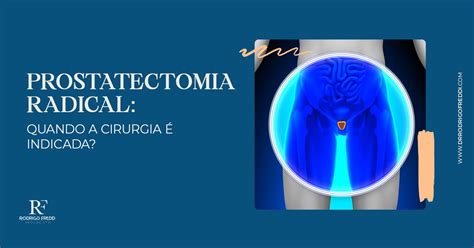 Prostatectomia Radical Quando A Cirurgia Indicada Dr Rodrigo Freddi