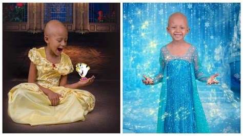 5 Year Old Battling Cancer Proves ‘bald Is Beautiful In Magical Disney