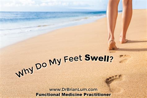 Why Your Feet Swell And How To Fix It