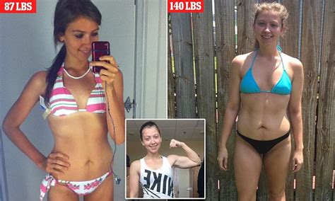 Virginia Woman Who Weighed Just Lbs Overcomes Anorexia Daily Mail Online