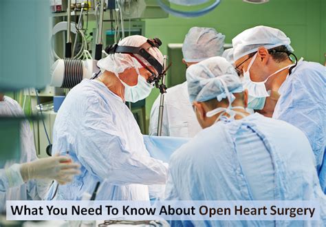 What You Need To Know About Open Heart Surgery