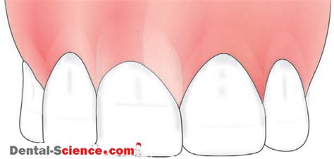 Types Of Human Teeth Function Shape Site Dental Science